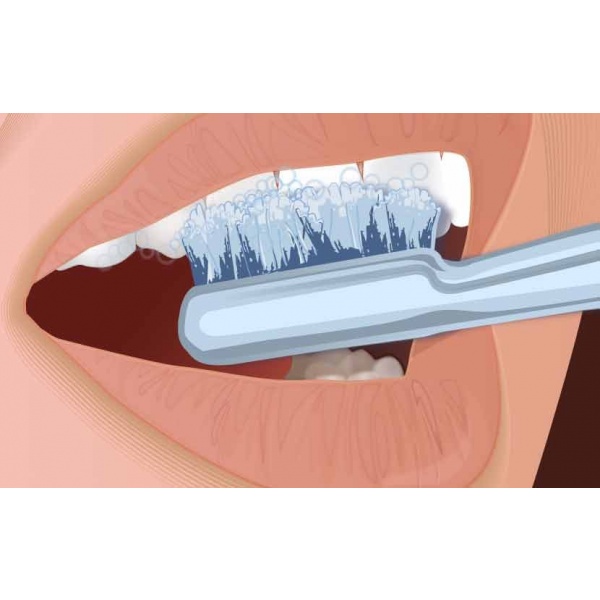 Step 7. Remove tray and brush your teeth, being careful not to swallow the remaining gel